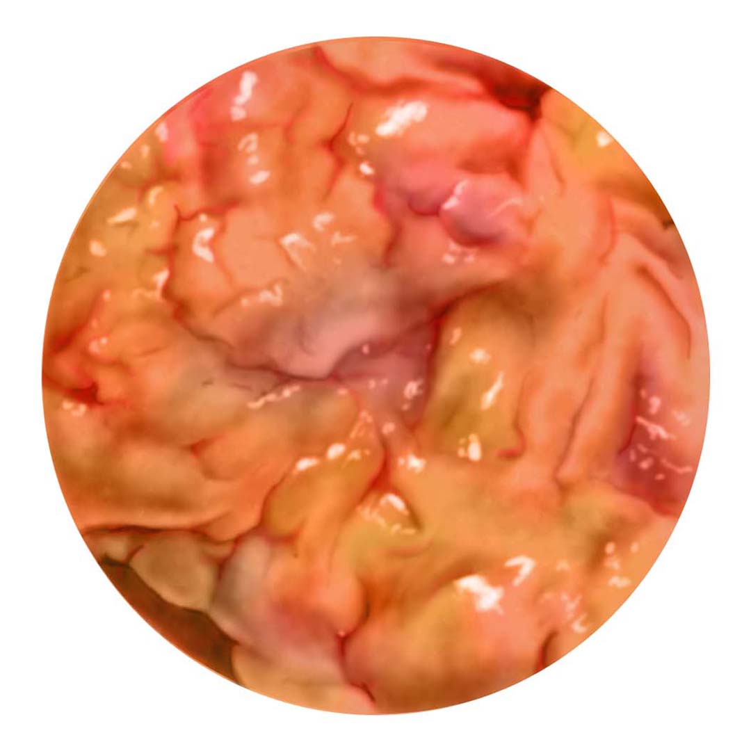 Photoshop painting of fatty tissue