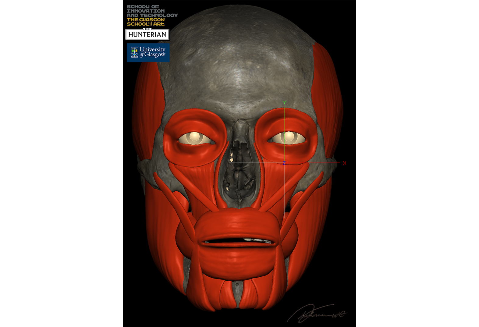 Modelling of the facial muscles as part of the Facial Reconstruction process using Geomagic Freeform.