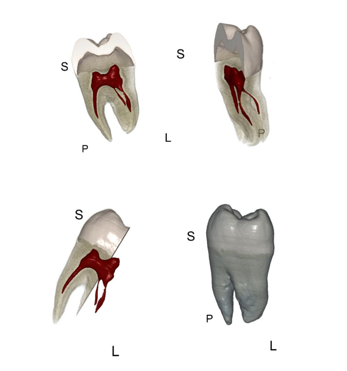Volumetric Visualisation of a tooth.