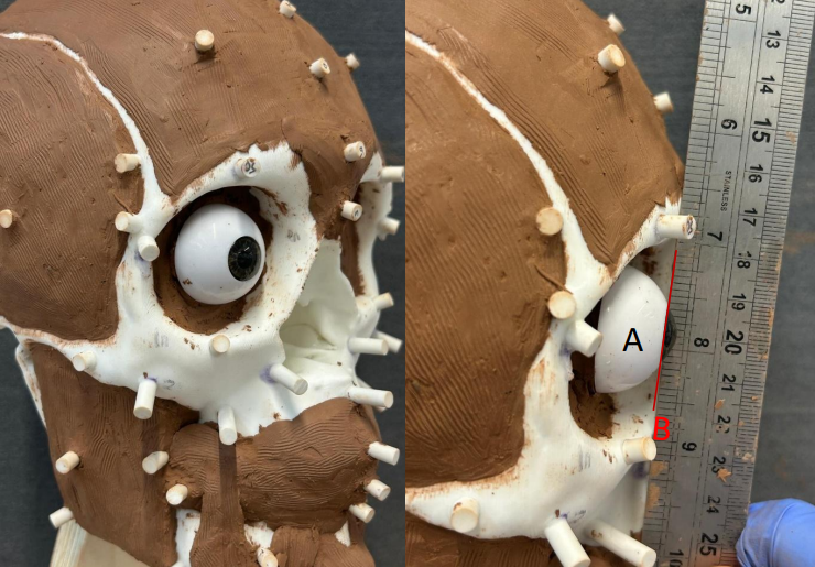 Physical 3D Facial Reconstruction project in clay on a 3D printed skull, segmented from a DICOM dataset. (BSc thesis project).